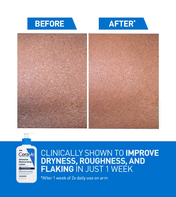 Intensive Moisturizing Lotion